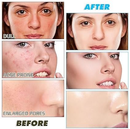 Turmeric and Kojic Acid Pads