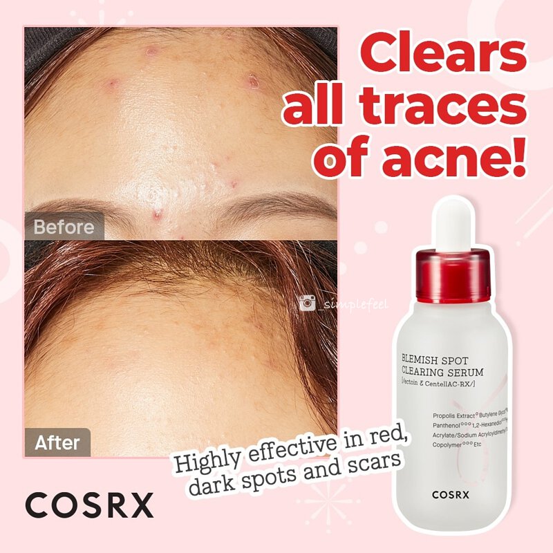 COSRX - Blemish Spot Clearing Serum