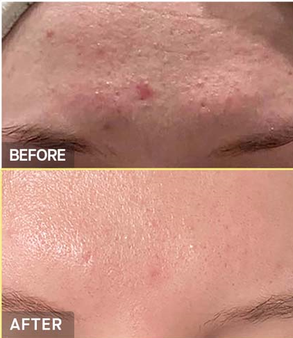 Snail Mucin Gel Cleanser