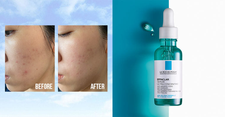 La Roche-Posay - Effaclar Ultra Concentrated Serum