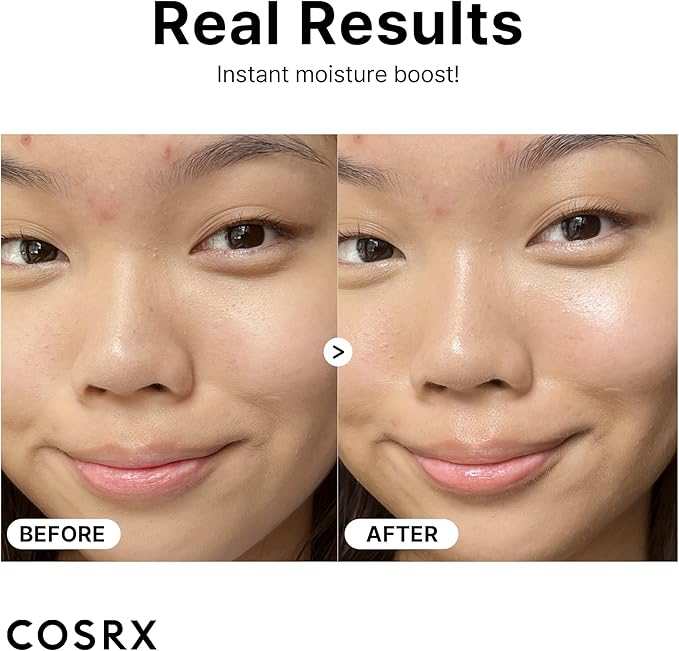 COSRX - The Hyaluronic Acid 3 Serum