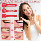 2 Pcs SP-6 Ultra Whitening Toothpaste