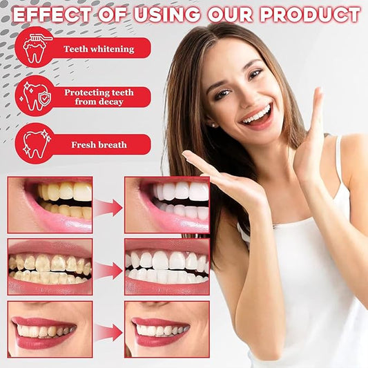 2 Pcs SP-6 Ultra Whitening Toothpaste