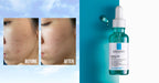 La Roche-Posay Effaclar Acne Serum with Salicylic Acid 30 ml
